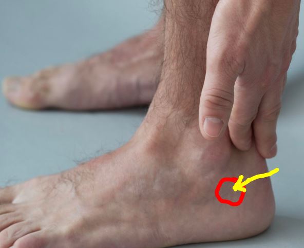 ankle bone.JPG